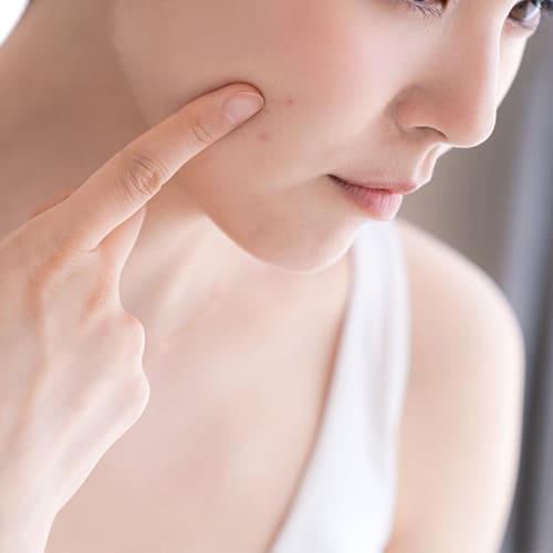 Close-up of a person touching their cheek with a finger, suggesting skin care concerns. Tips for healthier skin from the inside out.