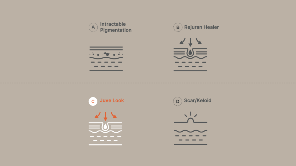 Diagram of skin conditions and treatments showing Intractable Pigmentation, Rejuran Healer, Juve Look, and Scar/Keloid