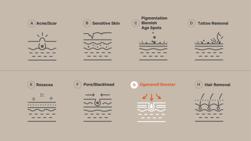 Skincare treatment diagram including solutions for acne scars, sensitive skin, pigmentation, blemishes, age spots, tattoo removal, rosacea, pore and blackhead treatment, hair removal, and OganaCell Booster