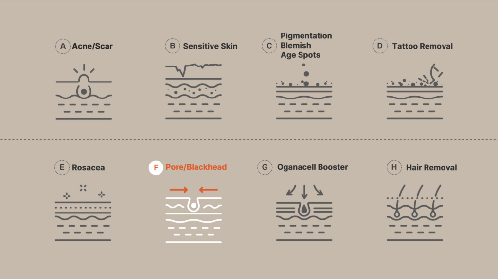 Diagrams illustrating dermatological treatments including acne scars, sensitive skin, pigmentation blemishes, tattoo removal, rosacea, pore blackhead treatment, Oganacell booster, hair removal